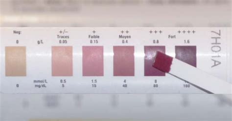 walgreens uti test strips results